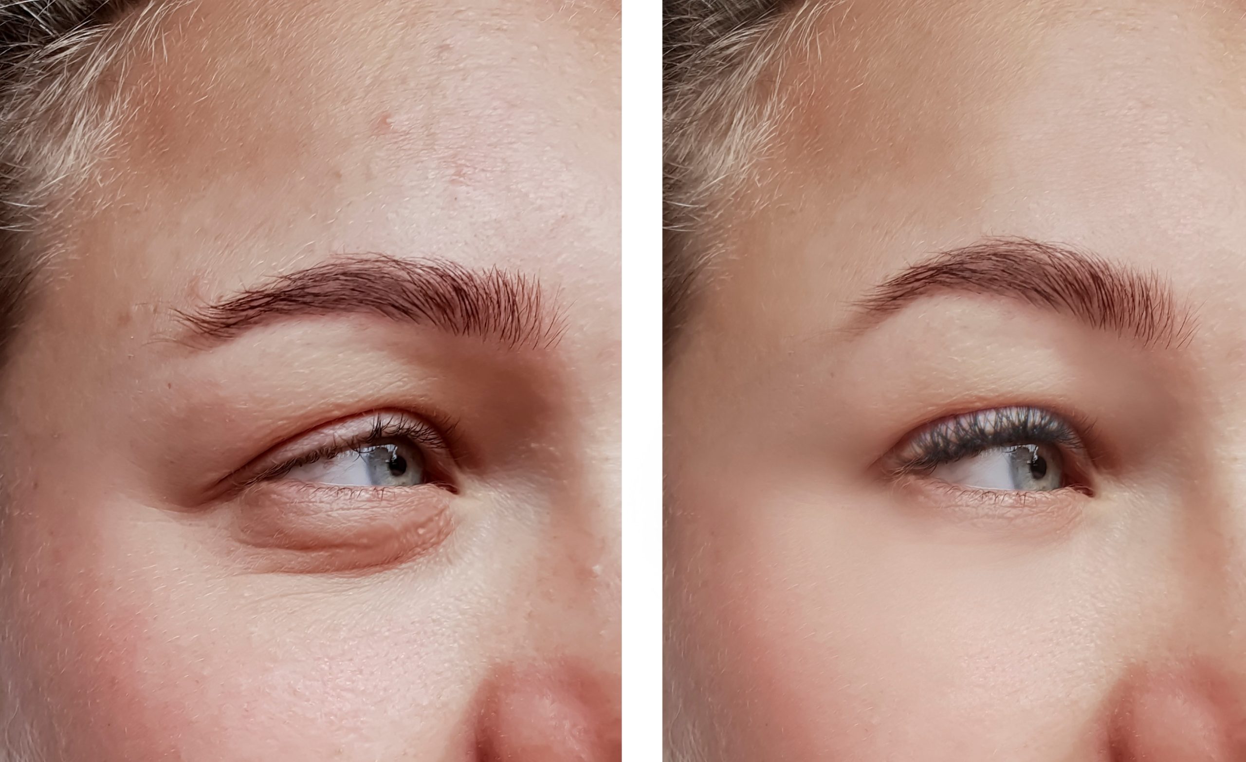 113986361 m normal none