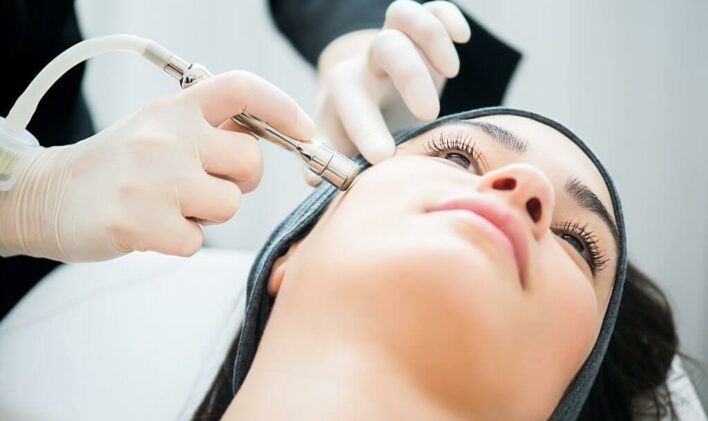 microdermabrasion